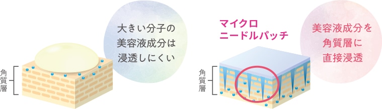 大きい分子の美容液成分は浸透しにくい マイクロニードルパッチは美容液成分を角質層に直接浸透