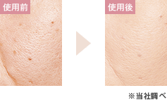 使用前 使用後の写真 ※ドクタープログラム調べ