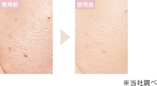 使用前 使用後の写真 ※ドクタープログラム調べ